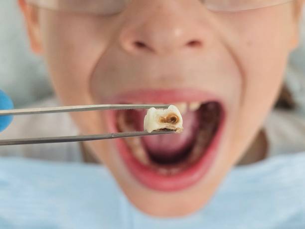 Best Pediatric Emergency Dentist in Wakarusa, IN